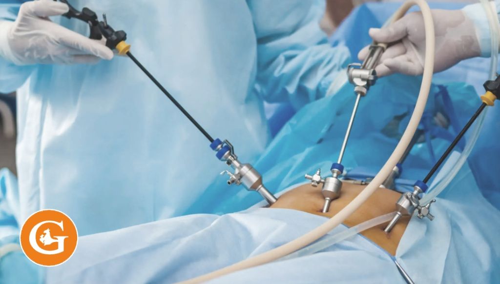 Лапароскопия диагностическая